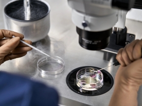 Fertilitätserhaltung für junge Frauen: Egg Freezing als bewusste und entspannte Option Fertilitätserhaltung für junge Frauen: Egg Freezing als bewusste und entspannte Option