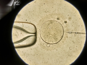 Was passiert im IVF-Labor?  Ein Blick hinter die Kulissen von GYNEM