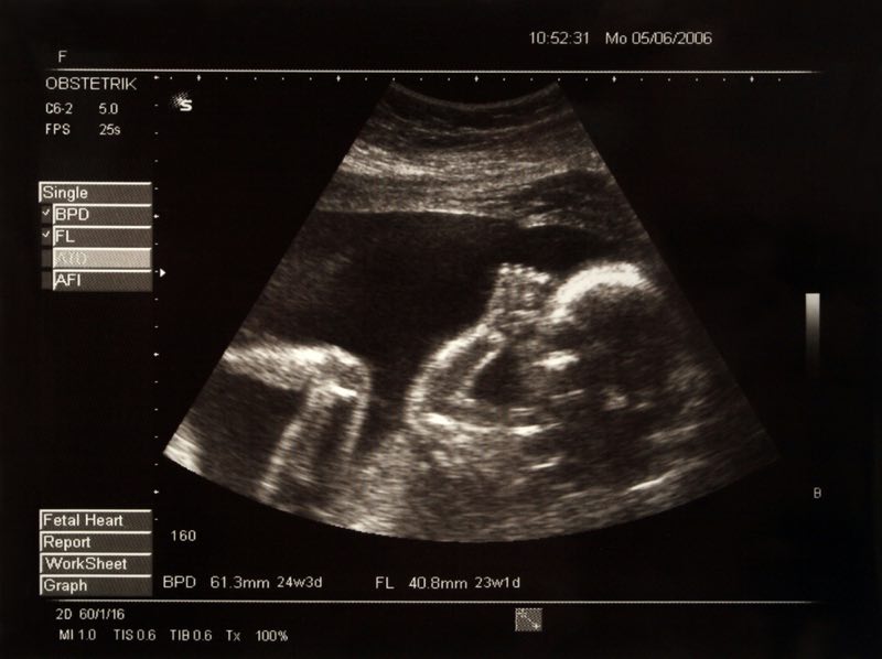 schwanger befruchtung